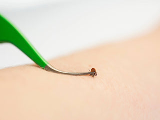 TickCheck Premium Tick Remover Kit - 3pc TickCheck